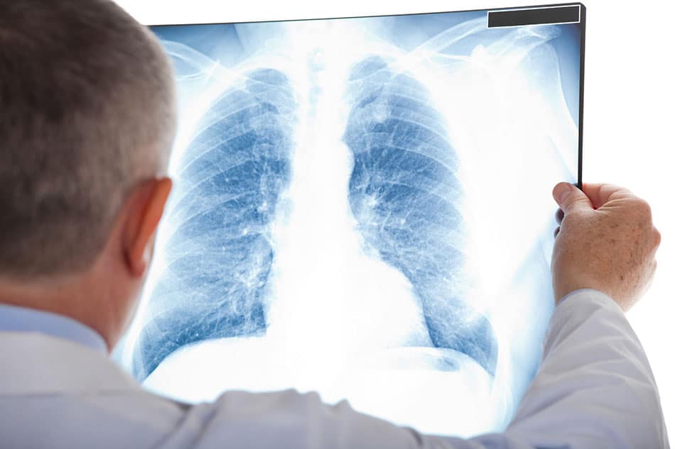 Neumólogos en Saltillo: Los Especialistas Respiratorios más Recomendados (2026) 1 Neumólogos en Saltillo: Los Especialistas Respiratorios más Recomendados (2026) 1